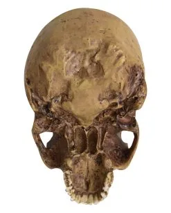 Antiker Totenschädel Ohne Unterkiefer 19cm -Halloween Deko Verkäufe antiker totenkopf ohne unterkiefer antiker totenschaedel ohne unterkiefer gothic deko 53262 04